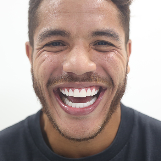 Diseño de Sonrisa de Jonathan Dos Santos