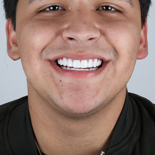 Diseño de Sonrisa de Christian Nodal